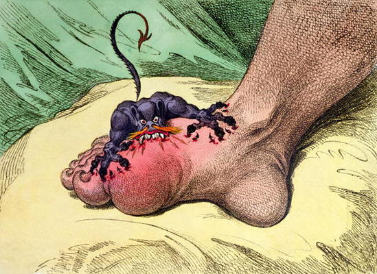 The Gout, published by Hannah Humphrey in 1799 (hand-coloured softdground etching) from James Gillray