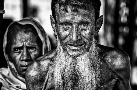Älterer Rohingya-Flüchtling – Bangladesch